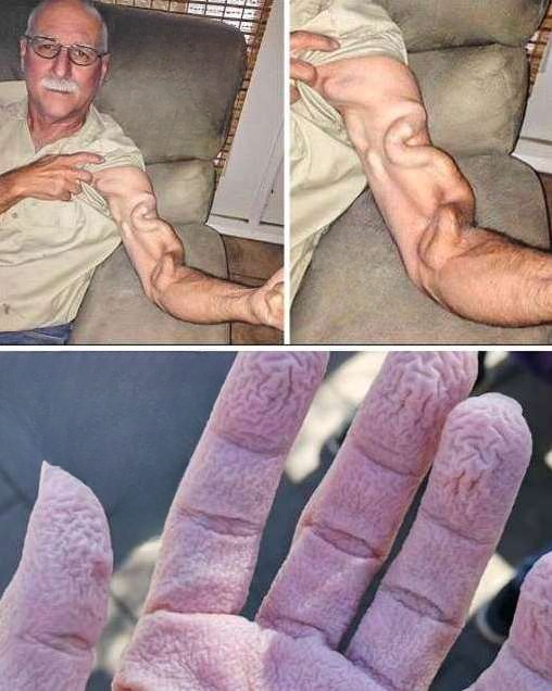 A man tried to stretch but suddenly felt a sharp pain in his arm—what happened next will surprise you