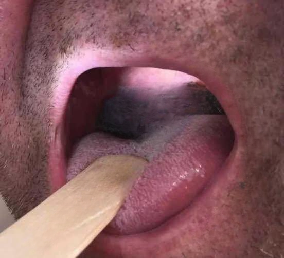 Shocking Effects on Your Body When You Eat