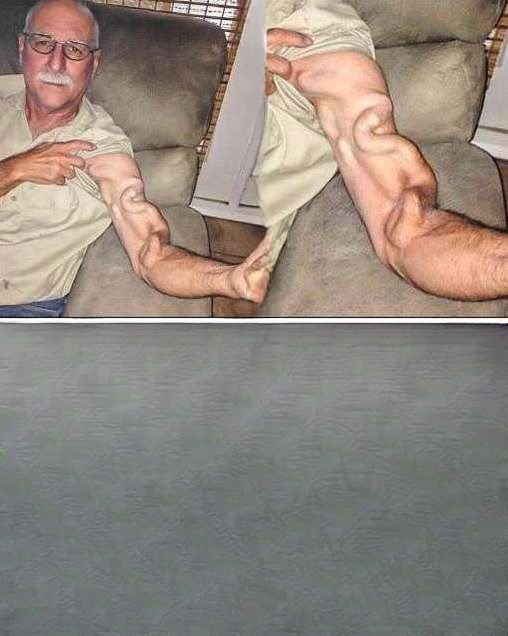 Routine Stretch Leads to Unexpected Arm Pain: A Cautionary Tale