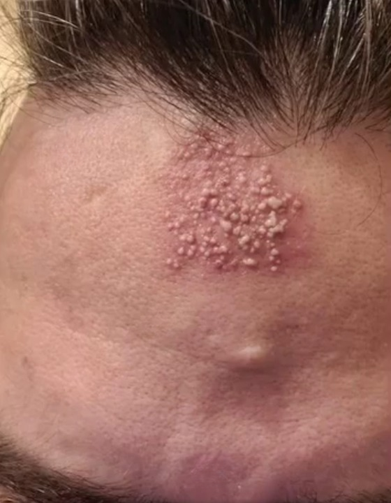 These are the consequences of sleeping with the lights on… See more