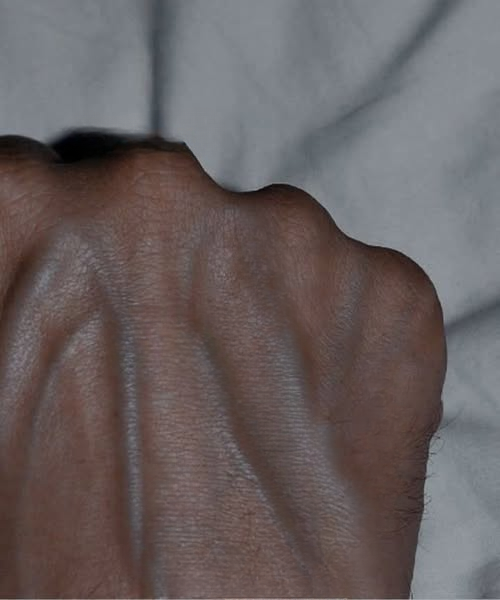 Prominent hand veins could be a sign of underlying health issues. Find out more!