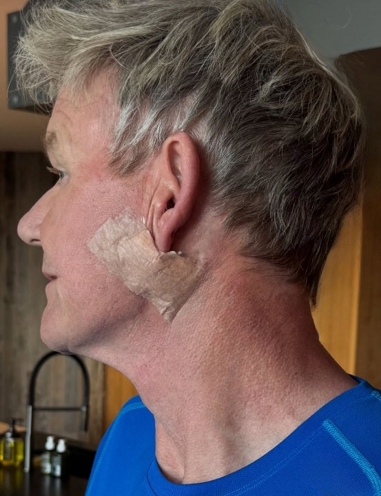 Gordon Ramsay Shares Health Struggle: Romeo Beckham, Daughter Holly, and Thousands of Fans Express Their Support